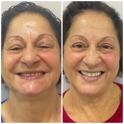 Antes e depois - 01