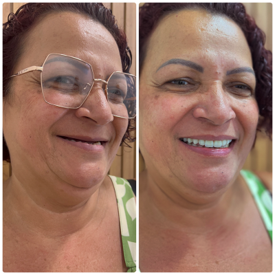 Antes e depois - 02