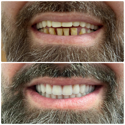 Antes e depois - 04