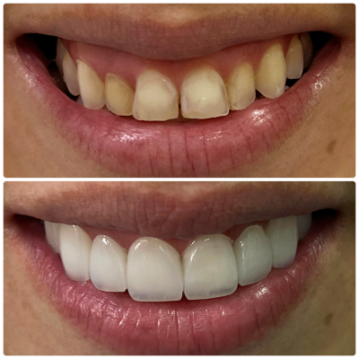 Antes e depois - 05